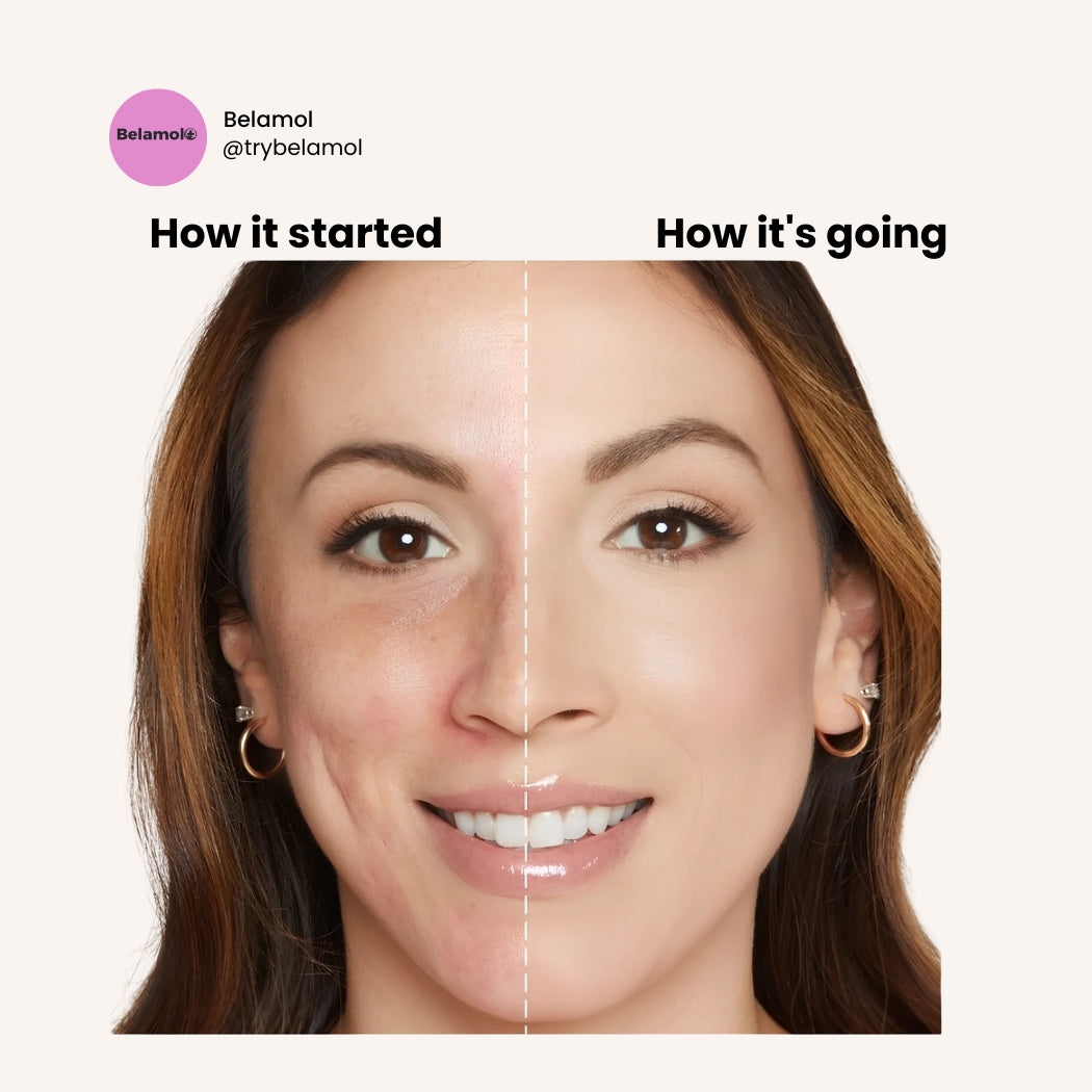 Belamol™ | Foundation 4 in 1